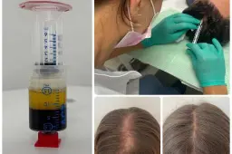 PRP Kasmetics
