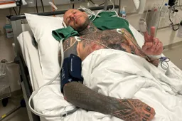 Maurizio Bottalico: incidente alla prima dell'Europeo su strada