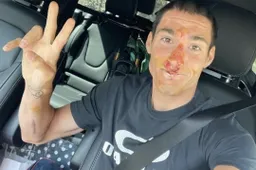 MotoGP, Aleix Espargarò: incidente in allenamento, ferite al volto