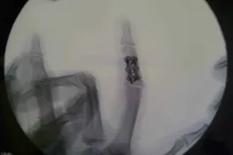 BSB: nuova operazione per John Hopkins, corre a Silverstone