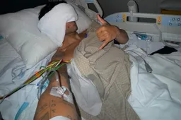 MotoGP, Jorge Martin: pneumotorace e undici fratture, resta in ospedale