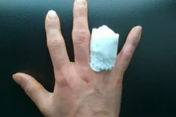 Superbike: amputazione dell'anulare destro per Hopkins