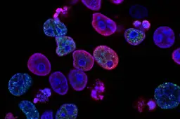 national cancer institute L7en7Lb Ovc unsplash