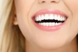 5 voordelen van thuis je tanden bleken met deze tandenbleekset
