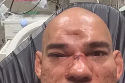 MMA-vechter Santos breekt schedel na vernietigende knock-out