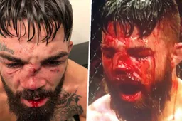 Fighter Mike Perry loopt de ziekste neusbreuk op uit de UFC geschiedenis