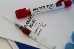 Eerste vrouw ooit genezen van het hiv-virus