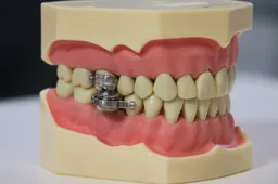 DentalSlim afvalapparaat lijkt door de duivel zelf ontworpen te zijn