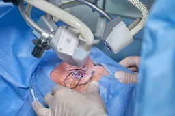 eye-laser-surgery-5016073_1280