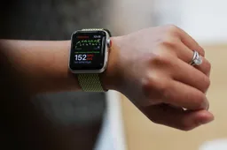 Apple Watch Series 4 show offs a bigger display in a leaked render
