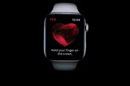 Research suggests Apple Watch heart rate data is not trustable