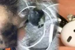 An explosion of Bluetooth headphones during use killed a person