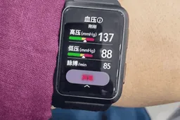 Huawei Watch D real image leaked - uses a square dial & measures high / low blood pressure