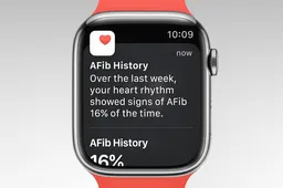 WatchOS 9 gets Canada approval for AFib history feature