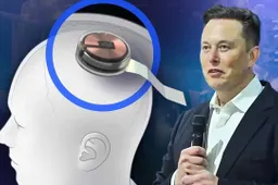 FDA Didn't Allow Elon Musk's Neuralink To Test Brain Implants On Humans
