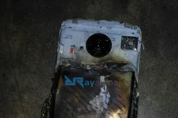 Moto E4 Plus Explosion Leave Burns On A Man's Leg In India