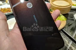 Nokia 7.1 Plus/X7 appears in new real-life images