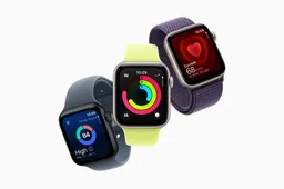 Apple Watch 2027 Overhaul: New Band System Will End Legacy Compatibility