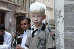 albino 3438707 1920