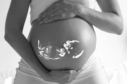 pregnant 518793 960 720 zwangere vrouw echo