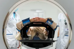 RIVM adviseert MRI-scans voor vrouwen met dicht borstweefsel