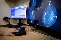 Drie nieuwe dure medicijnen tegen borstkanker nog niet vergoed