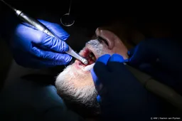 Mensen met minder inkomen of opleiding hebben een slechter gebit