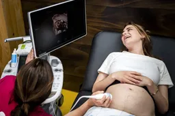 Onderzoek: hersenen van vrouwen veranderen door zwangerschap