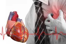 Kartel straft hartpatiënten keihard af: Levensreddende revalidatie uit het basispakket geschrapt