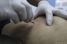 Aanbieders alternatieve behandeling 'wet cupping' vaak onbevoegd