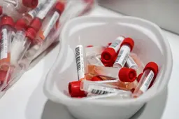 Coronavirus heeft bij alle eredivisieclubs een ingang gevonden