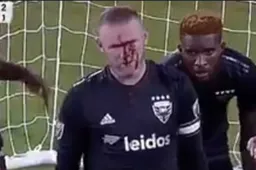 Wayne Rooney loopt verschrikkelijke blessure op