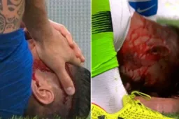 Olivier Giroud loopt verschrikkelijke blessure op vlak voor WK