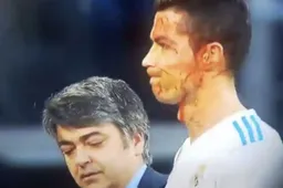 Cristiano Ronaldo scoort, bloedt en doet dan dit (Video)