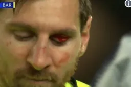 Vreselijke beelden van Messi in Champions League (VIDEO)