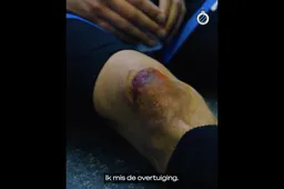 Straffe beelden: Sterkhouder ziet zwaar af bij Club Brugge (VIDEO)