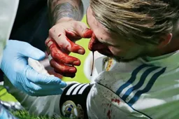 Verschrikkelijke blessure voor Sergio Ramos