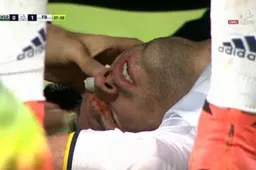 Grote paniek: Van Persie loopt vreselijke oogblessure op (Video)
