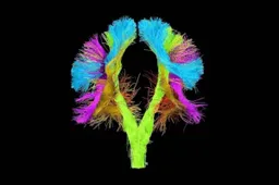 neurochirurgie-foto-2-web800-600x400