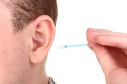 13223664 m normal none