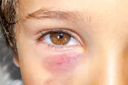 shutterstock 2484005405