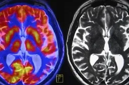 brain-scan-260nw-273127421