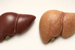 lever-gezond-vs-vervet