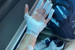 Zevende etappe levert ook slachtoffer op: Verona flink gehavend na 'domste val'