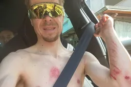 Ontstelde Tratnik (Jumbo-Visma) laat van zich horen: 'Auto-ongelukken kunnen wreed zijn'