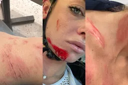 📸 Ook Vollering en Mackaij schrikken van gehavende Paternoster op Instagram: 'Take care!'