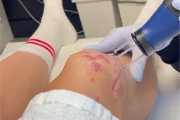 Terwijl de Giro hem lokt met een perfect openingsweekend, deelt Van Aert nieuwe beelden van zijn knie