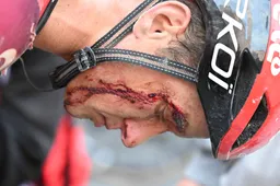 Breuken, hechtingen en kneuzingen: overvol medisch bulletin na vele valpartijen in Strade Bianche