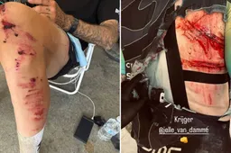 Voormalig Ajax-speler Jelle Van Damme belandt in prikkeldraad bij val tijdens Unbound Gravel