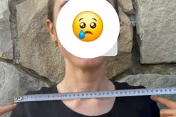 Kritiek op 'seksistische' regel omtrent stuurbreedte neemt toe: duizenden handtekeningen onder petitie